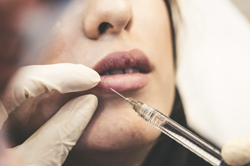 A woman receives a dermal filler injection in her lower lip.